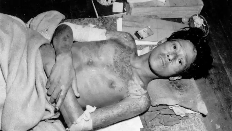 Nagasaki’den 80 Yıl Sonra Uyarı: Nükleer Felaket Tehlikesi Kapıda