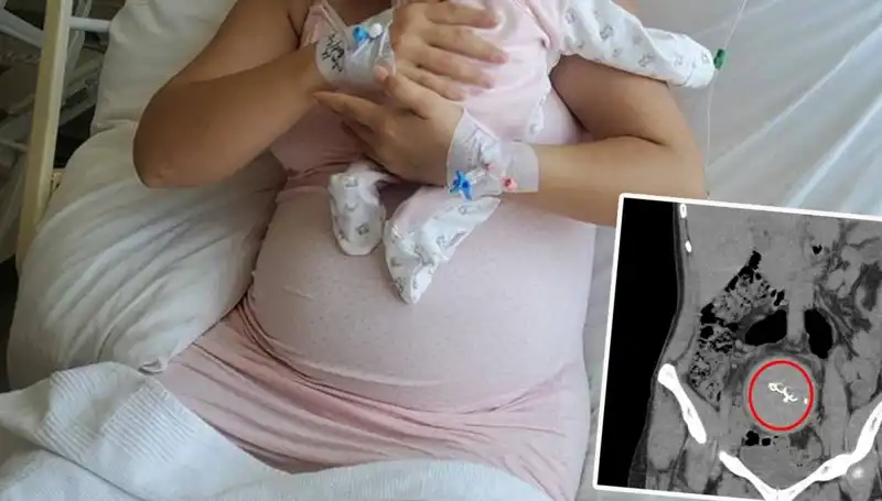 Doğumda Unutulan Bebek: Gazlı Bez İhmalinin Şok Edici Ayrıntıları